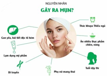 Những nguyên nhân hàng đầu gây ra mụn