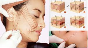 Tái Tạo Da Mặt Với Công Nghệ Hiện Đại 2