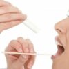 Nhiệt miệng ở lưỡi và những điều cần biết
